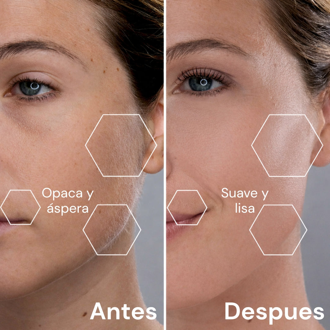 DermaLuxe™ Dermaplaning Sónico en Casa