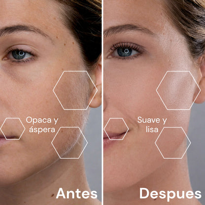 DermaLuxe™ Dermaplaning Sónico en Casa
